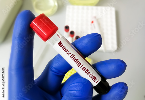 Blood sample for Mannose binding lectin or Mannan binding lectin test photo