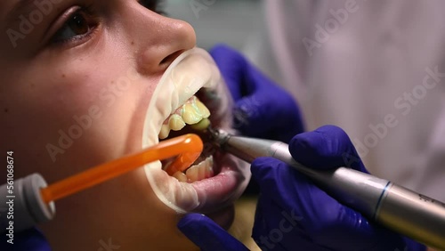 Close-up side view. Detail: dentist doctor doing professional cleaning dental plaque and polishing childs teeth, using a dental handpiece polishing brush at stomatology clinic. Pediatric dentistry photo