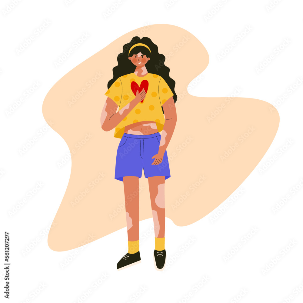 Flat design girl character with vitiligo. Body positive vitiligo skin love your self.