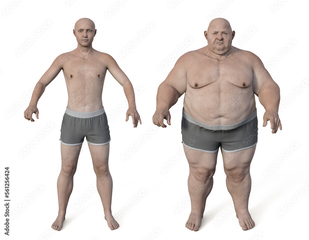 Fototapeta premium Obese man before and after gaining weight, 3D illustration. Concept of obesity