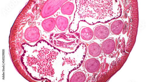 Ascaris lumbricoides under microscope. Haematoxylin end eosin stain. photo