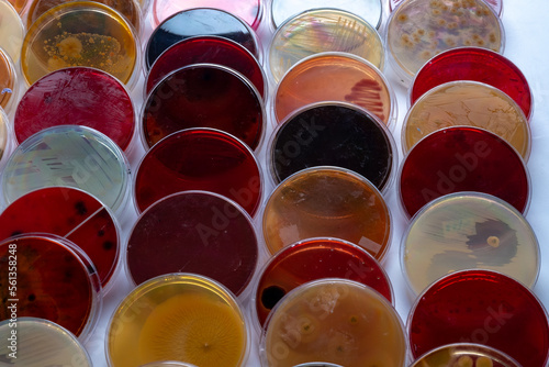 photo of bacteria and fungi growth on culture media in plastic plates photo