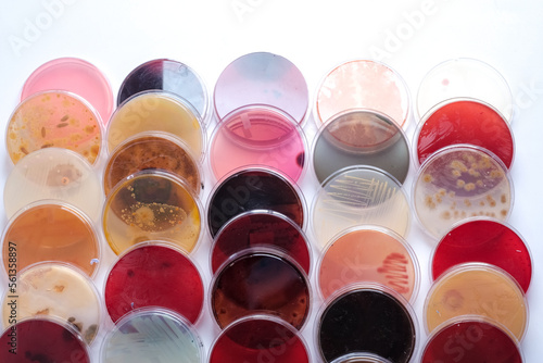 photo of bacteria and fungi growth on culture media in plastic plates photo