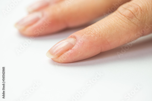 Nail health  female hands close-up 