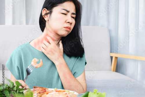 Asian woman have allergy reactions to shrimp or seafood have problems with rash, itching, and hives on the skin