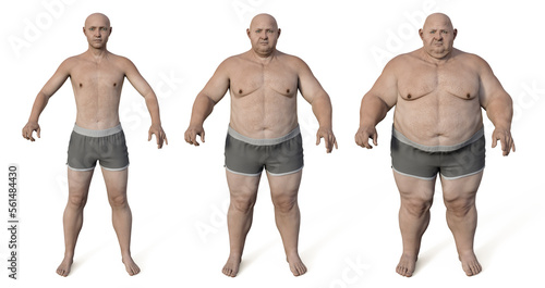 Obese man before and after gaining weight, 3D render not based on any photo. Concept of obesity