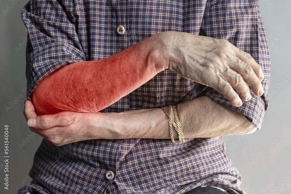 Pain in the upper arm of Asian elder woman. Concept of elbow and