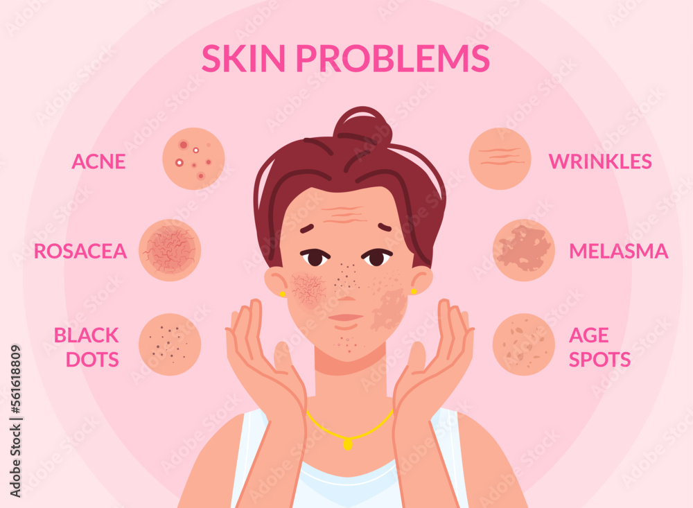 Types skin problems. Woman face with skins troubles, melasma pimple blemishes acne teenager problem blackhead cosmetic wrinkle spot scar facial redness, swanky vector illustration