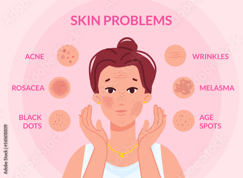 Types skin problems. Woman face with skins troubles, melasma pimple blemishes acne teenager problem blackhead cosmetic wrinkle spot scar facial redness, swanky vector illustration