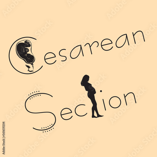 Cesarean section