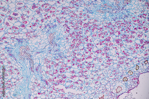 Host cells with spores (mold) are inside wood under the microscope for education. 