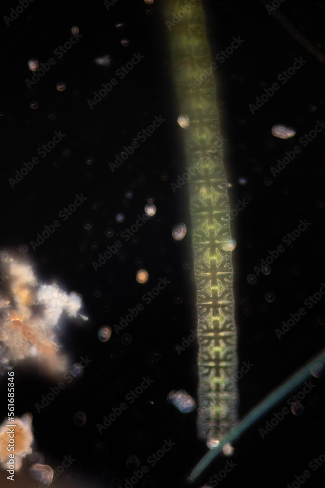 Study of protozoa and plant cells under the microscope for education ...