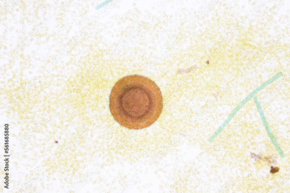 Study of protozoa and plant cells under the microscope for education ...