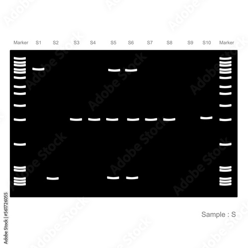 The agarose or polyacrylamide gel electrophoresis result of target nucleic acid or protein detection under the ultraviolet (UV) light or other after staining with dye detector.