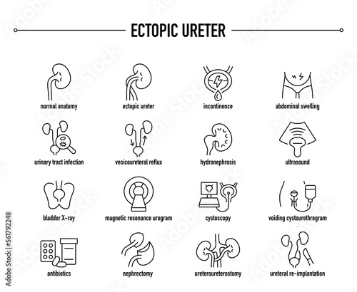 Ectopic Ureter symptoms, diagnostic and treatment icon set. Line editable medical icons. photo