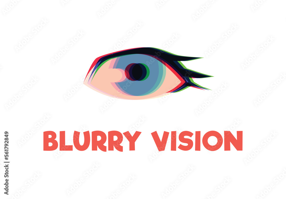 Blurry vision symptom, flat vector illustration isolated on white background. Blurry vision symptom, flat vector illustration isolated on white background.