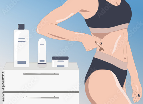 illustration.Girl pulls the skin on the abdomen, showing the body fat. Treatment and disposal of excess weight, the deposition of subcutaneous fat