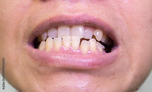 close up of a person distorted teeth