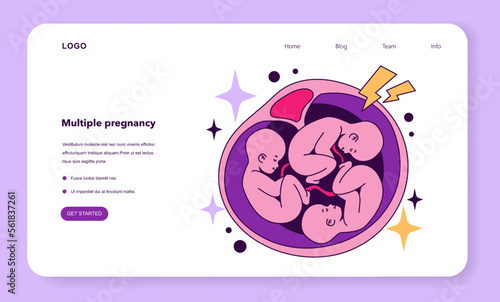 Multiple pregnancy as a disadvantage of In vitro fertilization web banner