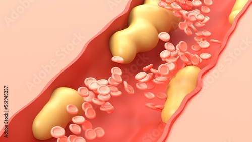 cholesterol and red blood cells 3d representation, blood flow that can represent the circulatory system. can be used to represent unhealthy eating, medical science or a heart attack photo