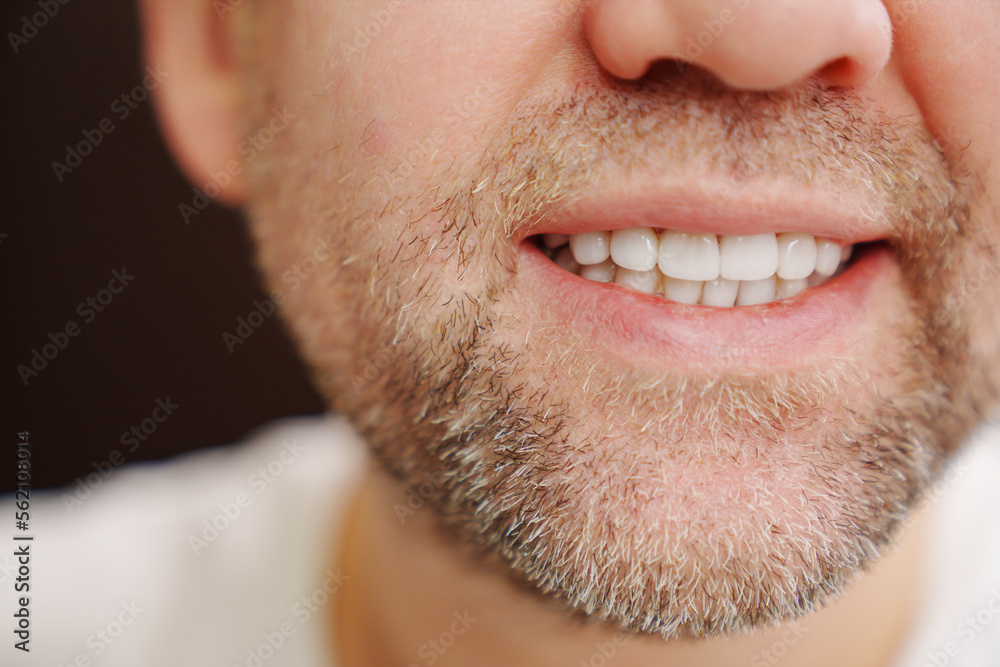 Obraz premium close-up. the man's mouth with stubble smiles and shows white teeth. the concept of dental services, whitening and veneers.