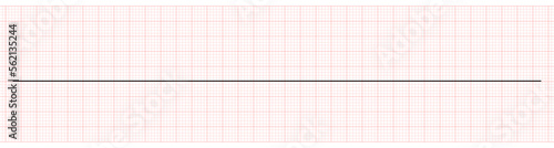 EKG Showing Sinus Bradycardia with Arrest of Patient 