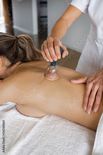 Unknown female therapist hands giving cupping treatment on a female back.