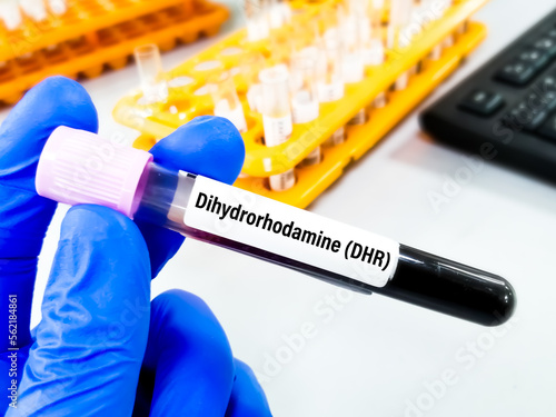 Blood sample for Neutrophil Function Test or Dihydrorhodamine (DHR) for the diagnosis of chronic granulomatous disease (CGD). photo