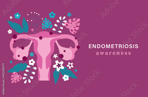 Endometriosis awareness background. Uterus with flower and leaf. Endometriosis awareness and uterus