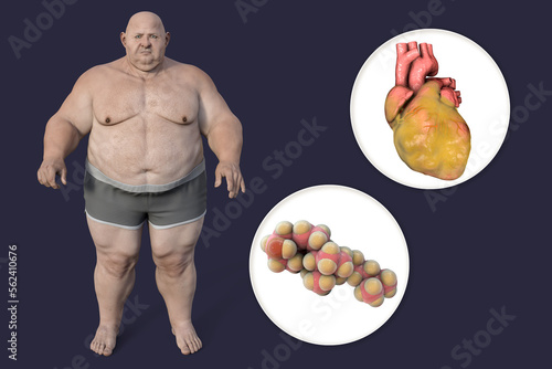 Molecule of cholesterol and obese heart in overweight man, 3D illustration. Concept of obesity and inner organs disease due to accumulation of cholesterol photo