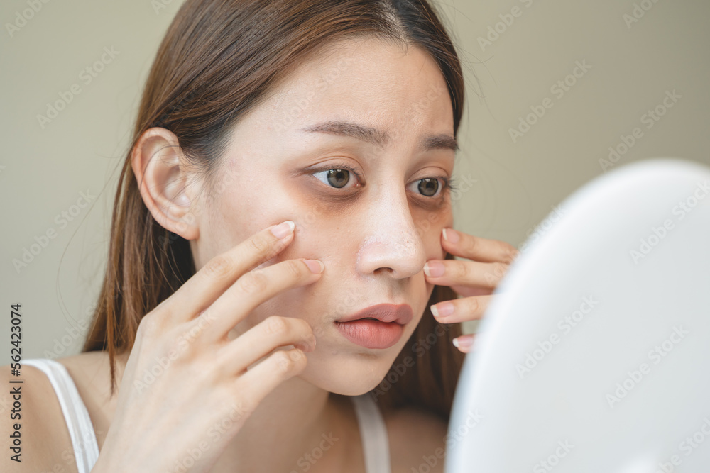 lack of sleep problem, Worried Asian young woman pointing finger at dark circles under her eyes lack of sleep problem, Worried Asian young woman pointing finger at dark circles under her eyes