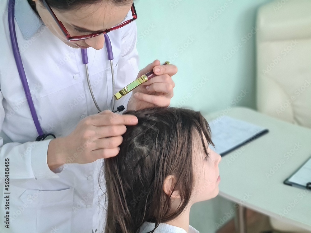 Doctor examines scalp of child with lice eczema of scalp Stock Photo