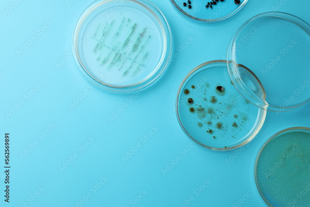 Petri dishes with different bacteria colonies on light blue background, flat lay. Space for text - obrazy, fototapety, plakaty 