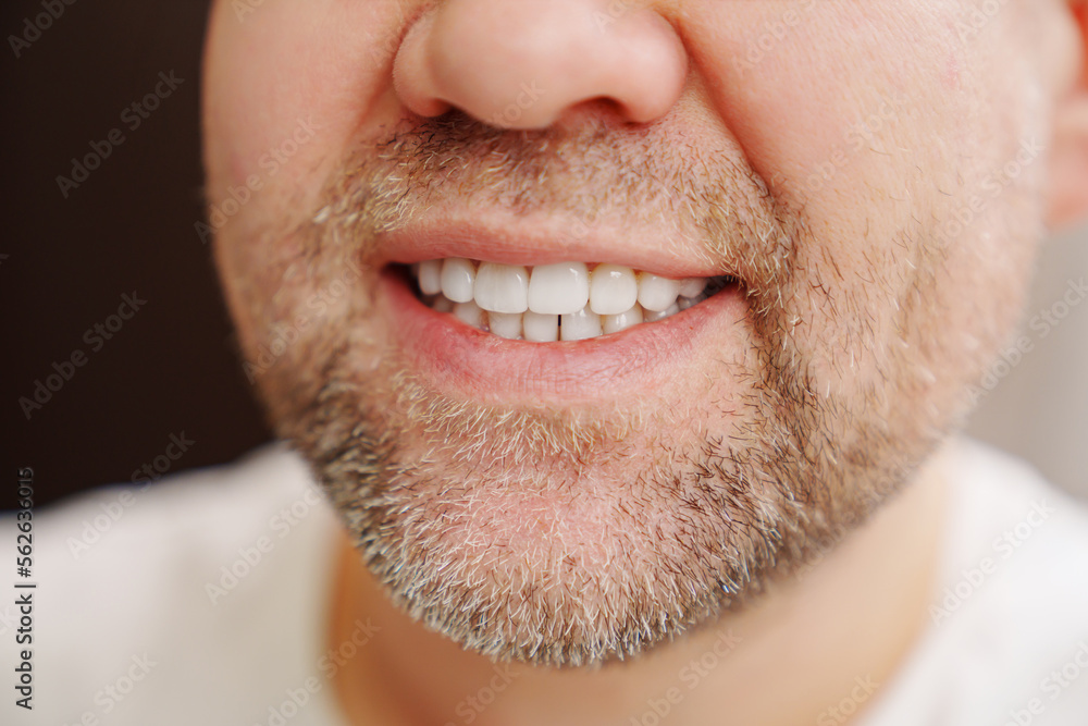 close-up. the man's mouth with stubble smiles and shows white teeth. the concept of dental services, whitening and veneers. close-up. the man's mouth with stubble smiles and shows white teeth. the concept of dental services, whitening and veneers.
