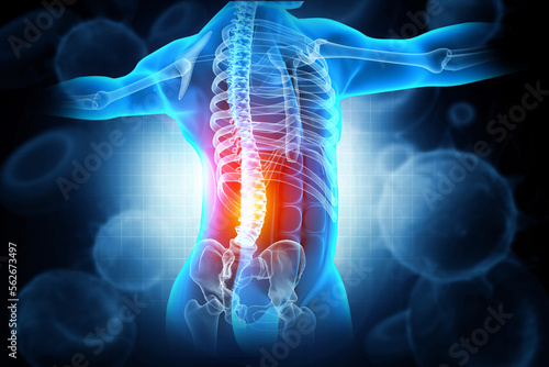 pain in the spine, pain in the back, highlighted in red, x-ray view. 3d illustration