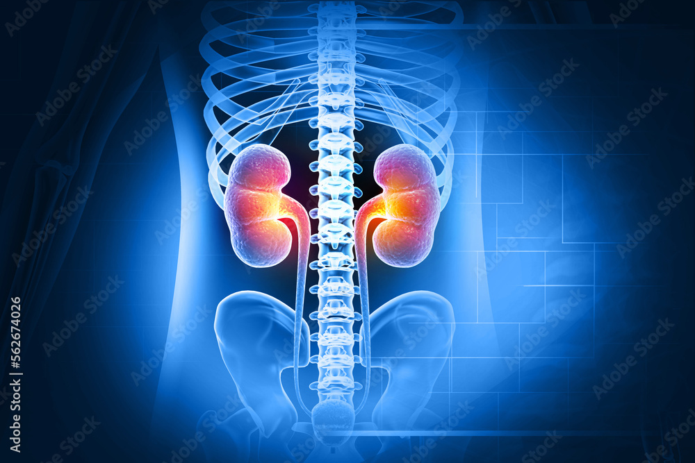 Human kidney medical diagram, anatomy of the kidney, diseased kidney