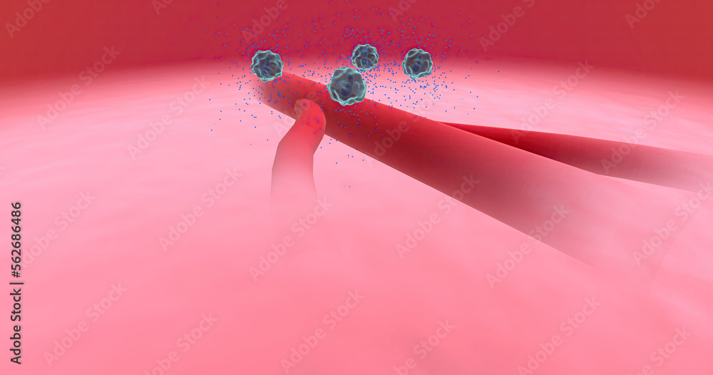 Anaphylaxis, Histamine Release and Vascular Edema Stock Illustration