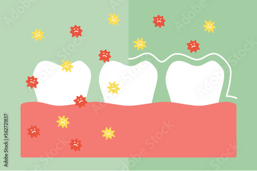 Compare tooth between by protection and not protection bacteria, microbe or virus around teeth - dental cartoon vector flat style