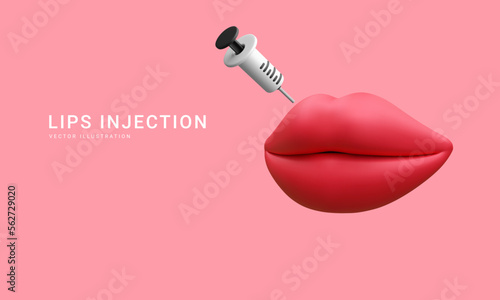 3d realistic banner for lip augmentation procedure. Lips injection of hyaluronic acid. Beauty clinic concept. Vector illustration