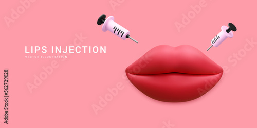 3d realistic banner for lip augmentation procedure. Lips injection of hyaluronic acid. Beauty clinic concept. Vector illustration