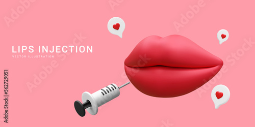 3d realistic banner for lip augmentation procedure. Lips injection of hyaluronic acid. Beauty clinic concept. Vector illustration