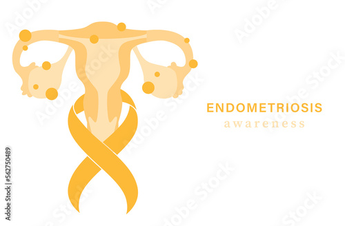 Endometriosis awareness background. Yellow ribbbon with uterus photo