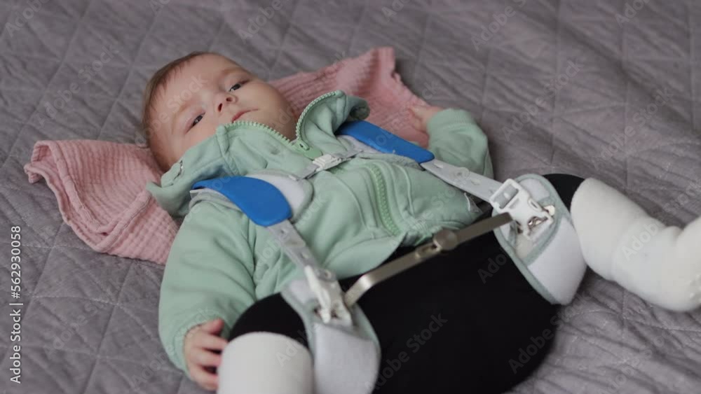 Baby girl lying on back wearing Pavlik Harness to correct Hip Dysplasia