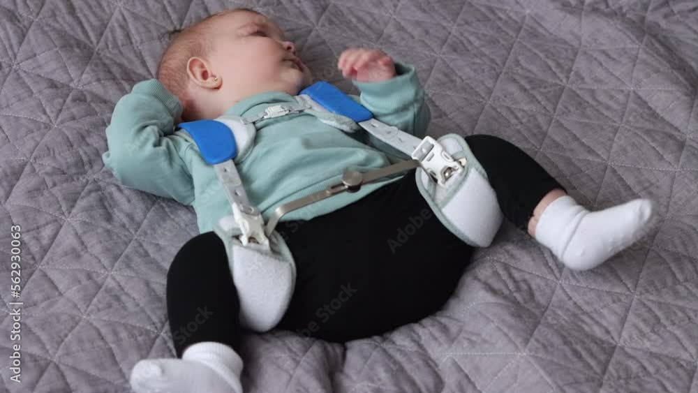 Tired baby girl wearing Pavlik Harness to correct Hip Dysplasia lies on