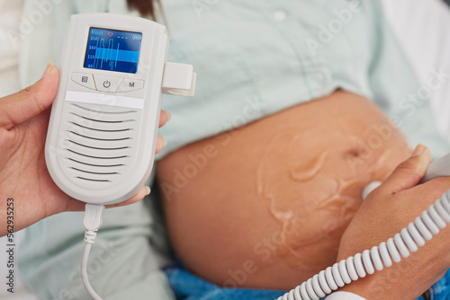 Slika na platnu Pregnant woman, doctor hands and heart rate monitor for baby healthcare, medical support or hospital gynecology