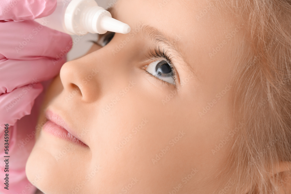 Ophthalmologist putting drops into little girl's eye in clinic, closeup