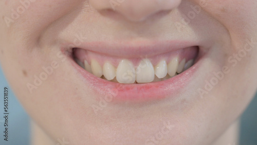 Close Up of Smiling Lips of Woman
