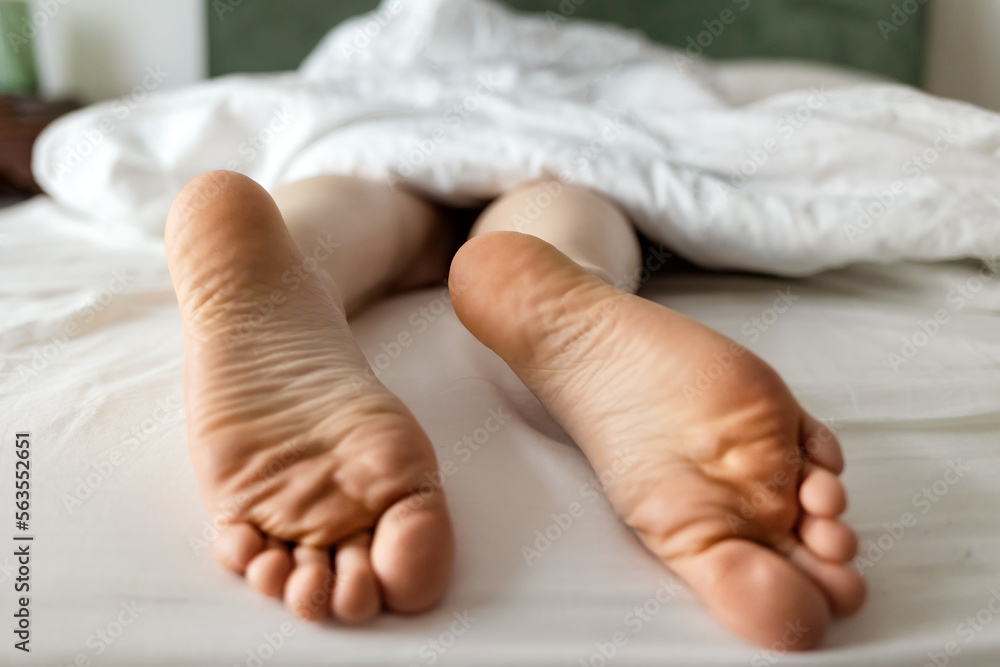Person's legs sticking out under blanket. Barefeet close-up with dry calluses and corns Person's legs sticking out under blanket. Barefeet close-up with dry calluses and corns