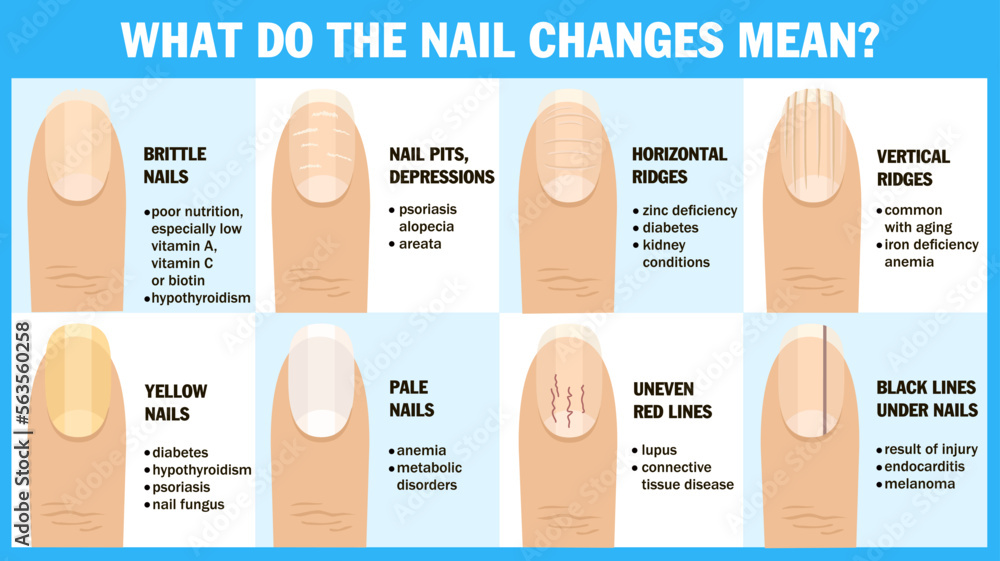 Fingernail Health Guide 101