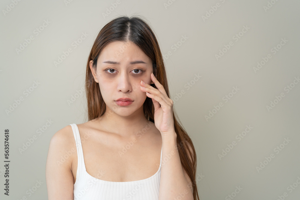 lack of sleep problem, Worried Asian young woman pointing finger at dark circles under her eyes lack of sleep problem, Worried Asian young woman pointing finger at dark circles under her eyes